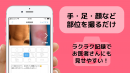 日本初の“アトピー治療見える化アプリ”をリリース　元アトピーのパパが無料iPhoneアプリ「アトピヨ」を開発！
