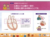 バイエル薬品様 患者指導用iPadアプリ「心房細動・脳梗塞診療サポートアプリ」を構築　～心房細動・脳梗塞患者の診療をサポートする医師専用のiPadアプリ～