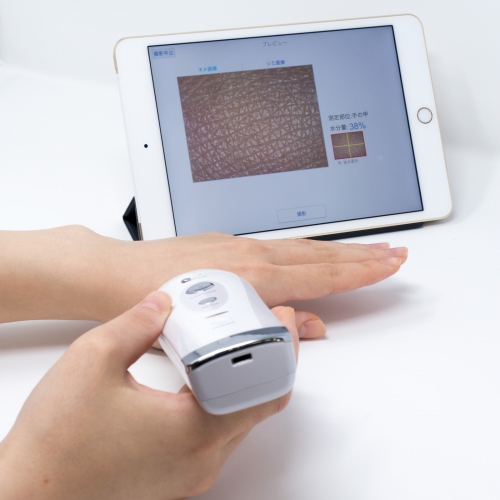 肌チェックシステム「Smart Skin Care(R)」を2017年6月販売開始　プロ品質の肌チェックと測定データ管理をスマホ／タブレットで簡単操作、カウンセリング強化を低コストで実現！