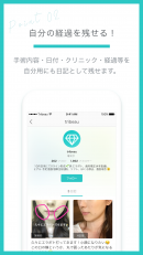 美容整形の術後経過記録・投稿ができるスマホアプリ「トリビュー」iOS・Android版 10/16配信開始