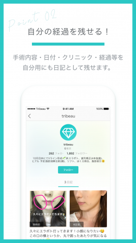 美容整形の術後経過記録・投稿ができるスマホアプリ「トリビュー」iOS・Android版 10/16配信開始